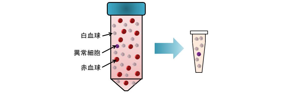 白血球、異常細胞、赤血球から赤血球を除去し、血中異常細胞を濃縮する図